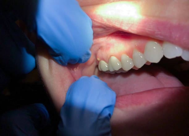 Best Broken or Cracked Tooth Emergency Dentist in Webster, FL