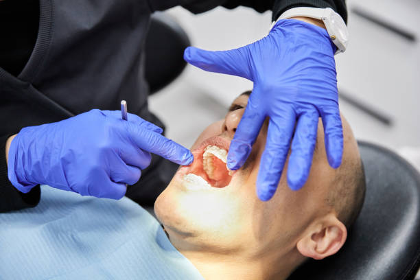 Best Emergency Root Canal Treatment in Webster, FL